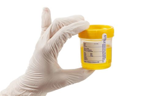 bottles to put urine in for drug test|sample bottles for urine test.